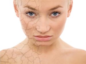 Remedios-Caseros-Para-la-Piel-Seca